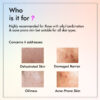 By NAKED fact Detoxifying Anti Acne Face Wash | For Pore Cleansing, Oil Control & Sebum Regulation | Treats Active Acne & Fades Acne Marks | Contains Salicylic Acid, Glycolic Acid & Niacinamide | Suitable for Oily, Combination and Acne-Prone Skin | Men & women | 100 ml - Image 8